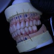 درخواست ارائه مجوز به دندانسازان تجربی‌کار